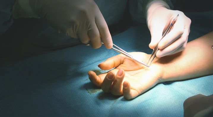 الجراحات الميكروسكوبية وجراحات اليد