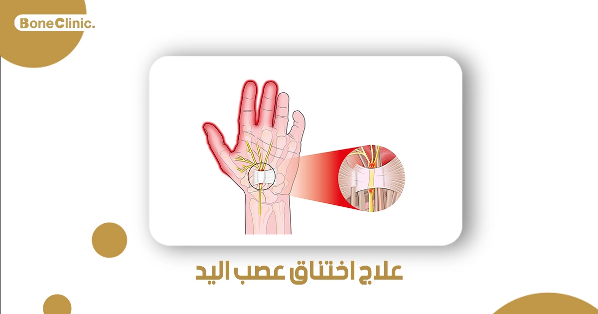 علاج اختناق عصب اليد