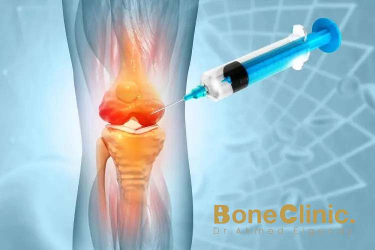 أضرار حقن حمض الهيالورونيك للركبة
