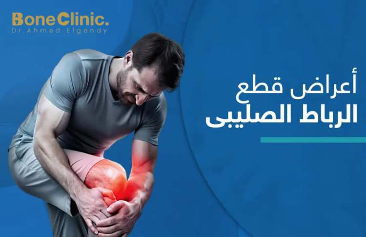 أعراض الإصابة بالرباط الصليبي