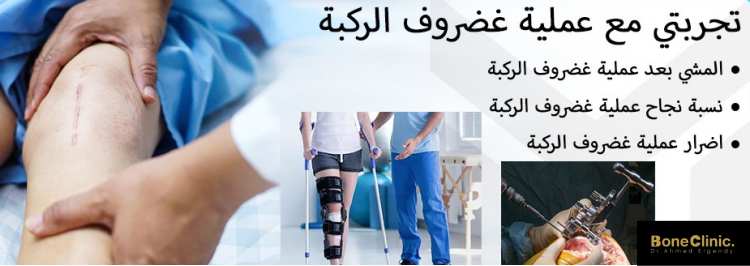 تجربتي مع عملية غضروف الركبة