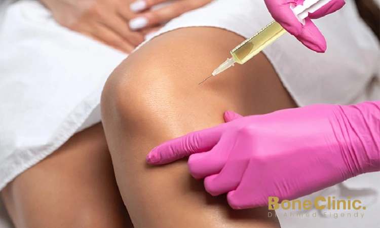 كيفية حقن حمض الهيالورونيك للركبة