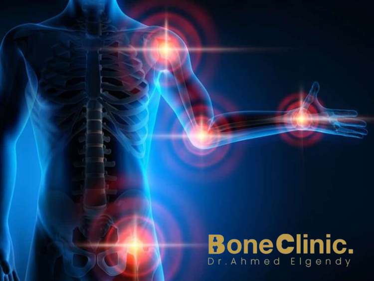 أعراض أمراض الجهاز العضلي