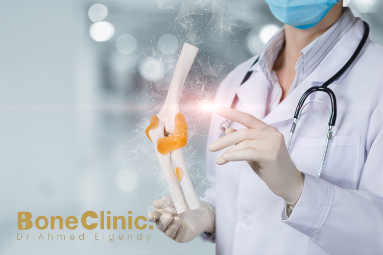 أفضل مركز جراحة العظام والمفاصل في مصر