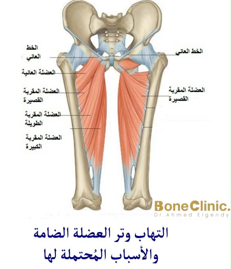 العناية بالجسم والوقاية من التهاب العضلة الضامة في العمل