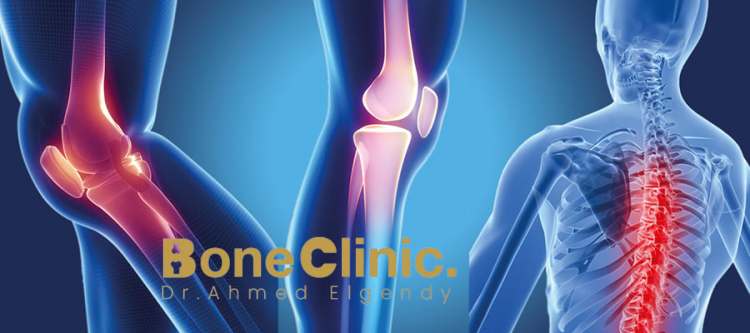 جراحة العظام والمفاصل