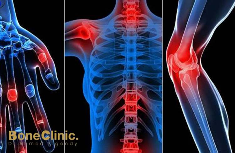 هل يمكن الشفاء من التهاب المفصل العجزي الحرقفي؟