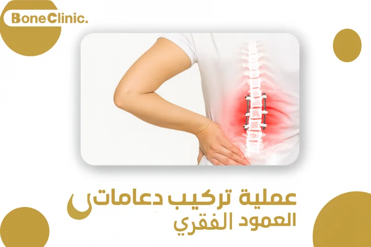 دعامات العمود الفقري