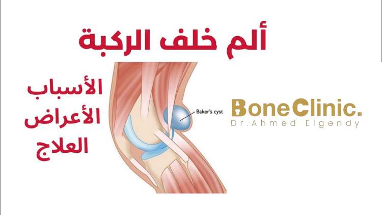علاج ألم عند ثني الركبة من الخلف