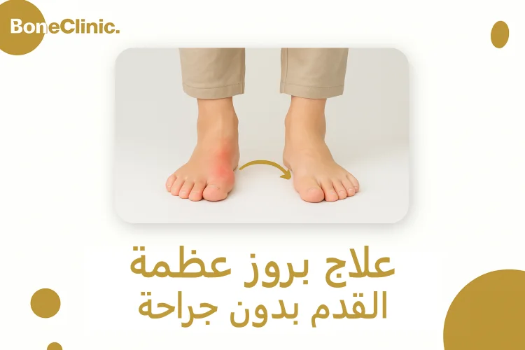 علاج بروز عظمة القدم بدون جراحة