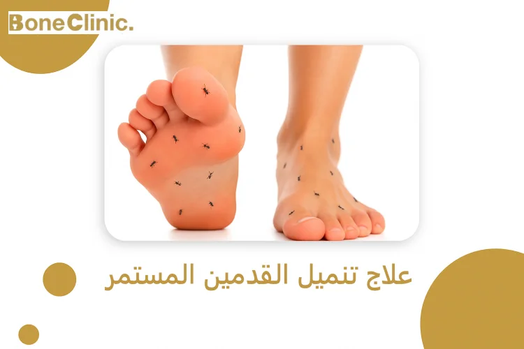 علاج تنميل القدمين المستمر