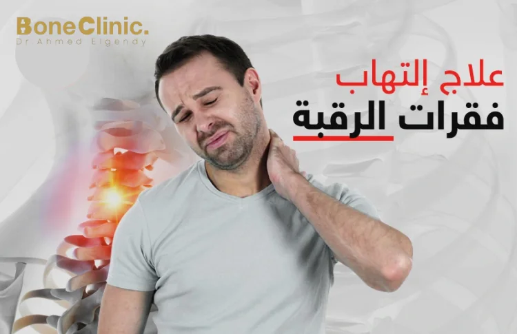 كيف يكون علاج التهاب الفقرات العنقية؟