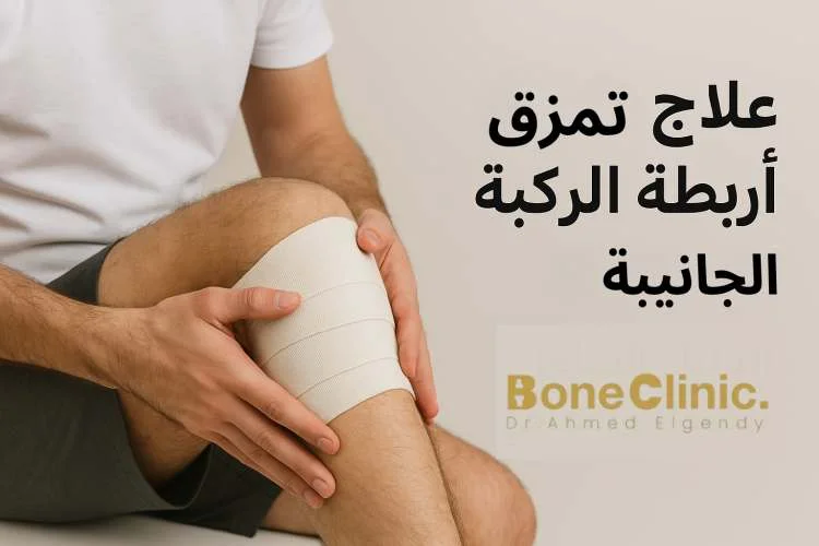 كيف يمكن علاج الرباط الجانبي الوحشي؟