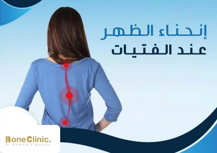 ما هو انحناء الظهر الطبيعي للمرأة؟