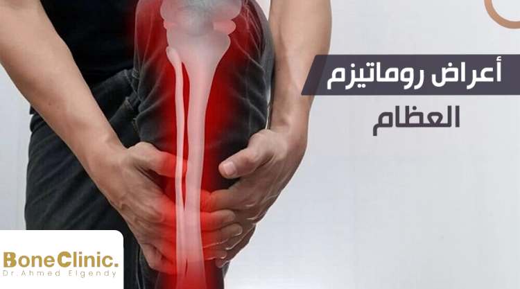 ما هي أعراض روماتيزم العظام؟