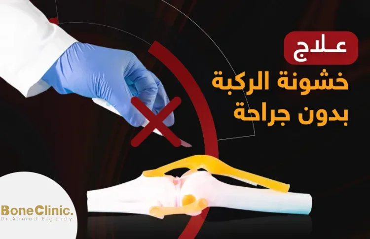 هل يمكن علاج خشونة الركبة بدون جراحة؟