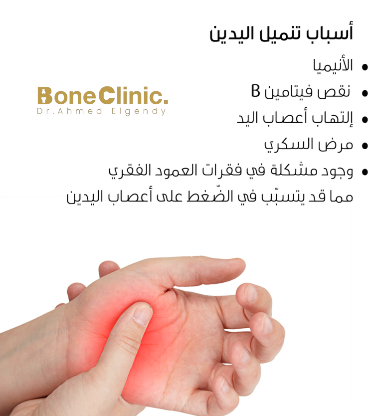 اسباب التنميل في الاطراف