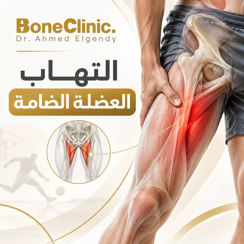 التهاب العضلة الضامة