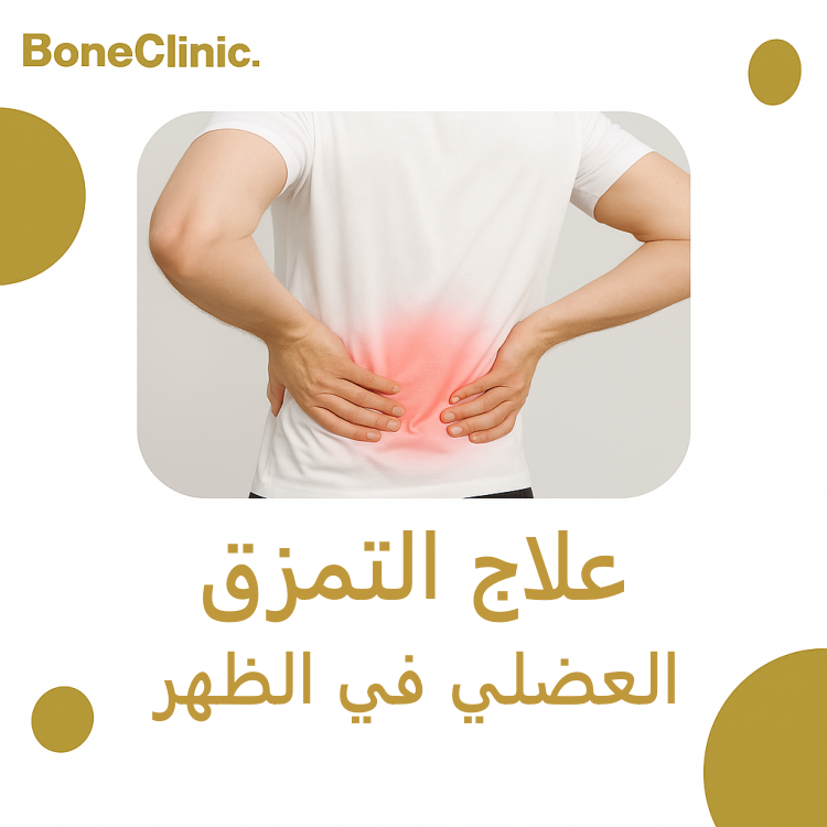 علاج التمزق العضلي في الظهر