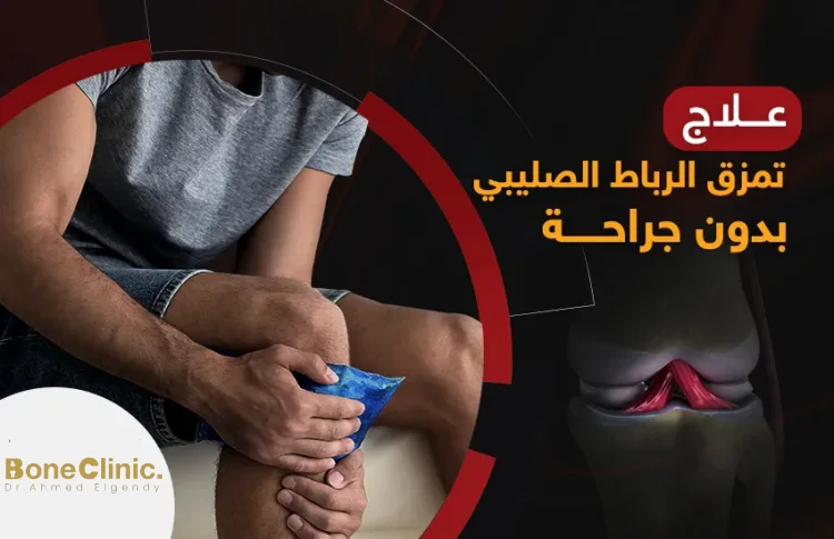 علاج تمزق الرباط الصليبي بدون جراحة