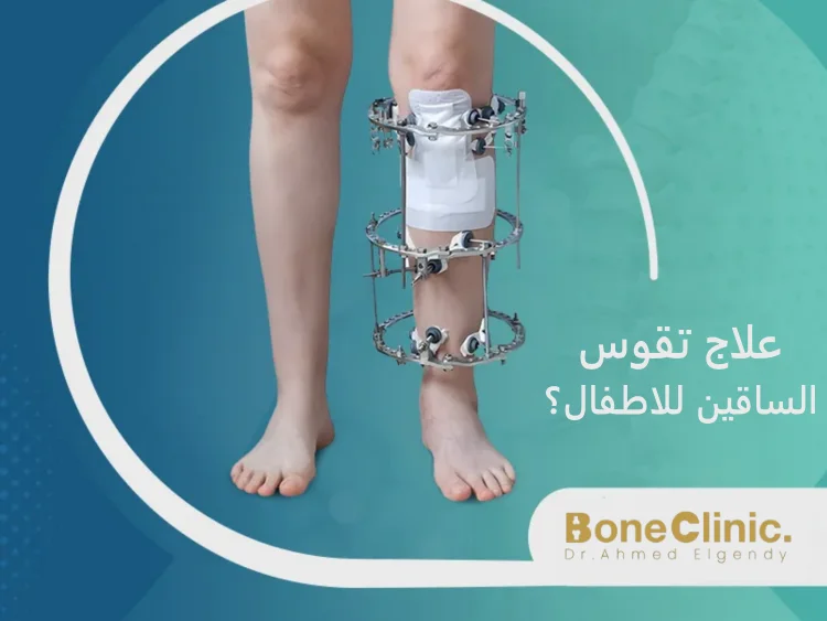 كيف يمكن علاج تقوس الساقين للاطفال؟