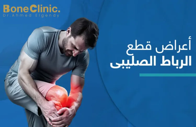 ما هي اعراض الرباط الصليبي