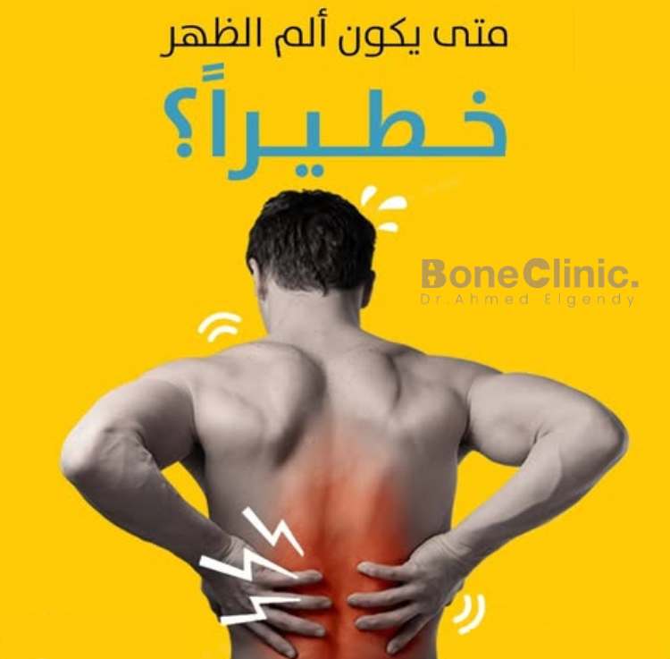 متى يكون ألم الظهر خطيرة 