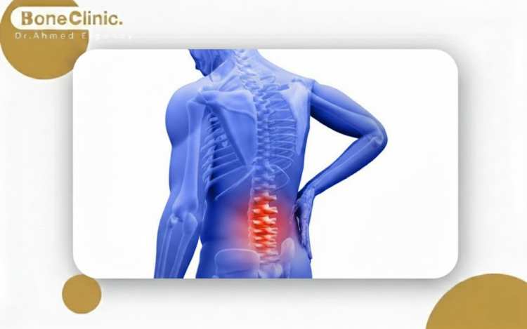 علاج الم الفقرات العصعصية