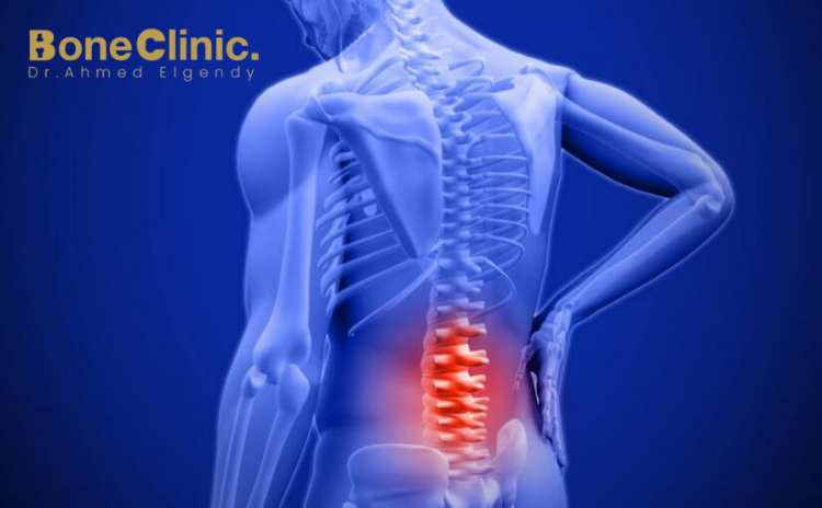 متى يكون ألم العصعص خطير؟