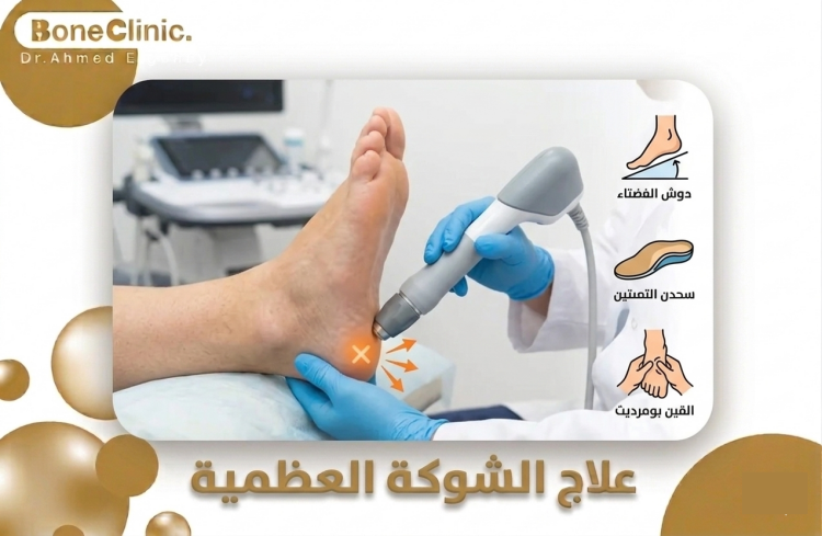 علاج الشوكة العظمية