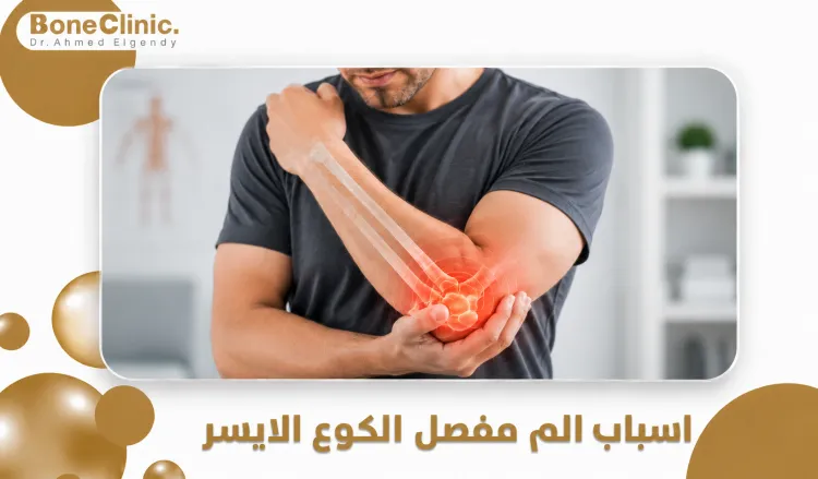 اسباب الم مفصل الكوع الايسر