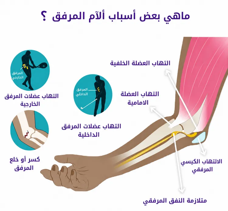 مفصل الكوع مفصل الكوع