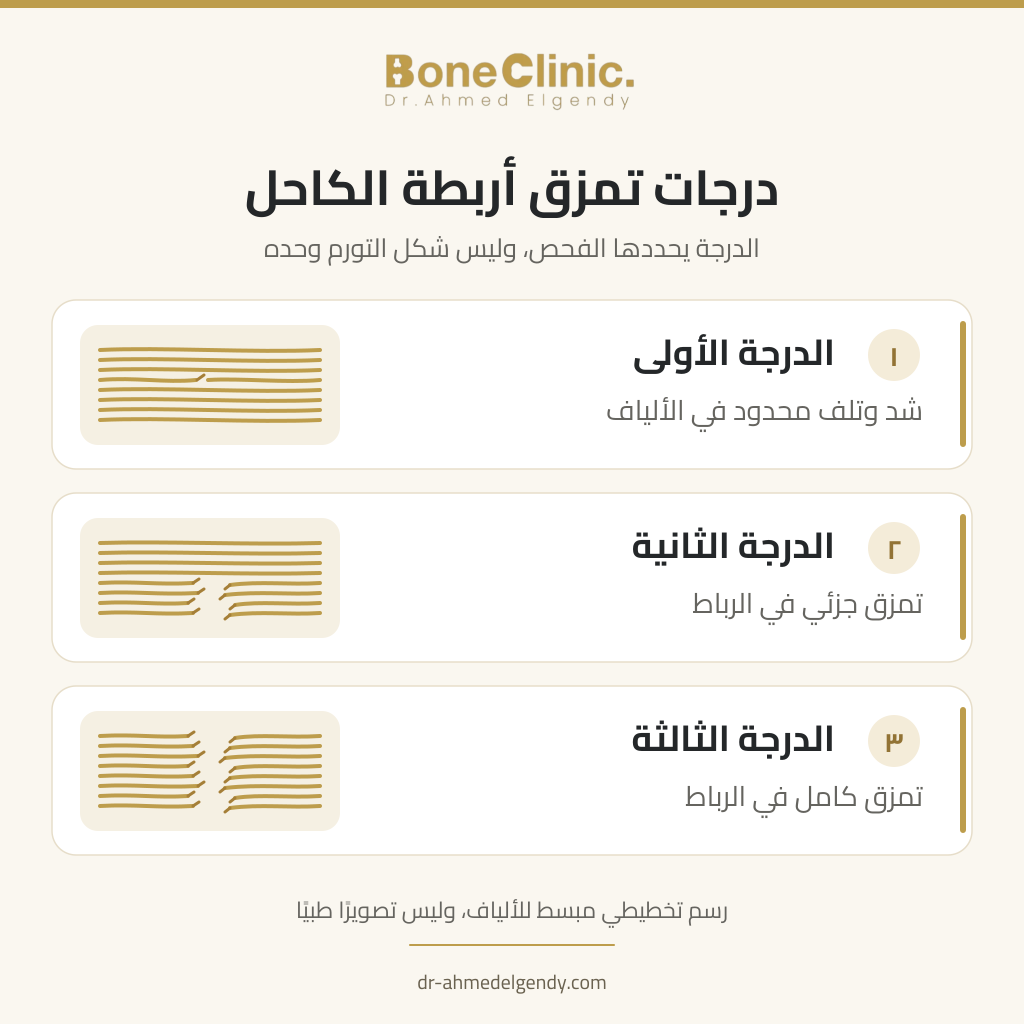 رسم مبسط لدرجات تمزق أربطة الكاحل من التلف المحدود إلى التمزق الجزئي والكامل