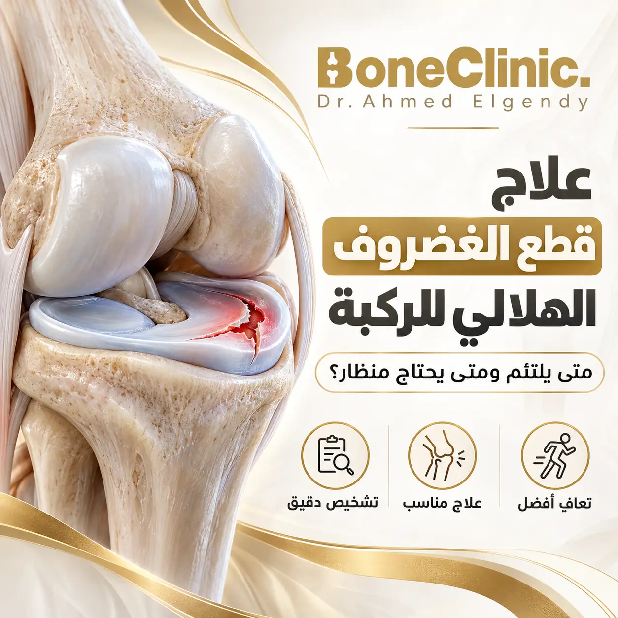 علاج قطع الغضروف الهلالي للركبة